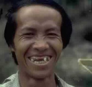 chino%252Bsin%252Bdientes%255B1%255D.JPG