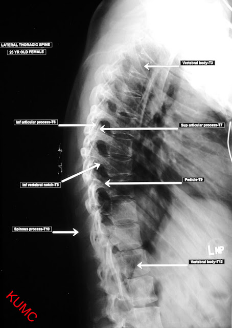 Radiographic positioning: Thoracic positioning