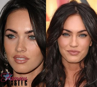 Angelina Jolie Plastic Surgery Before And After