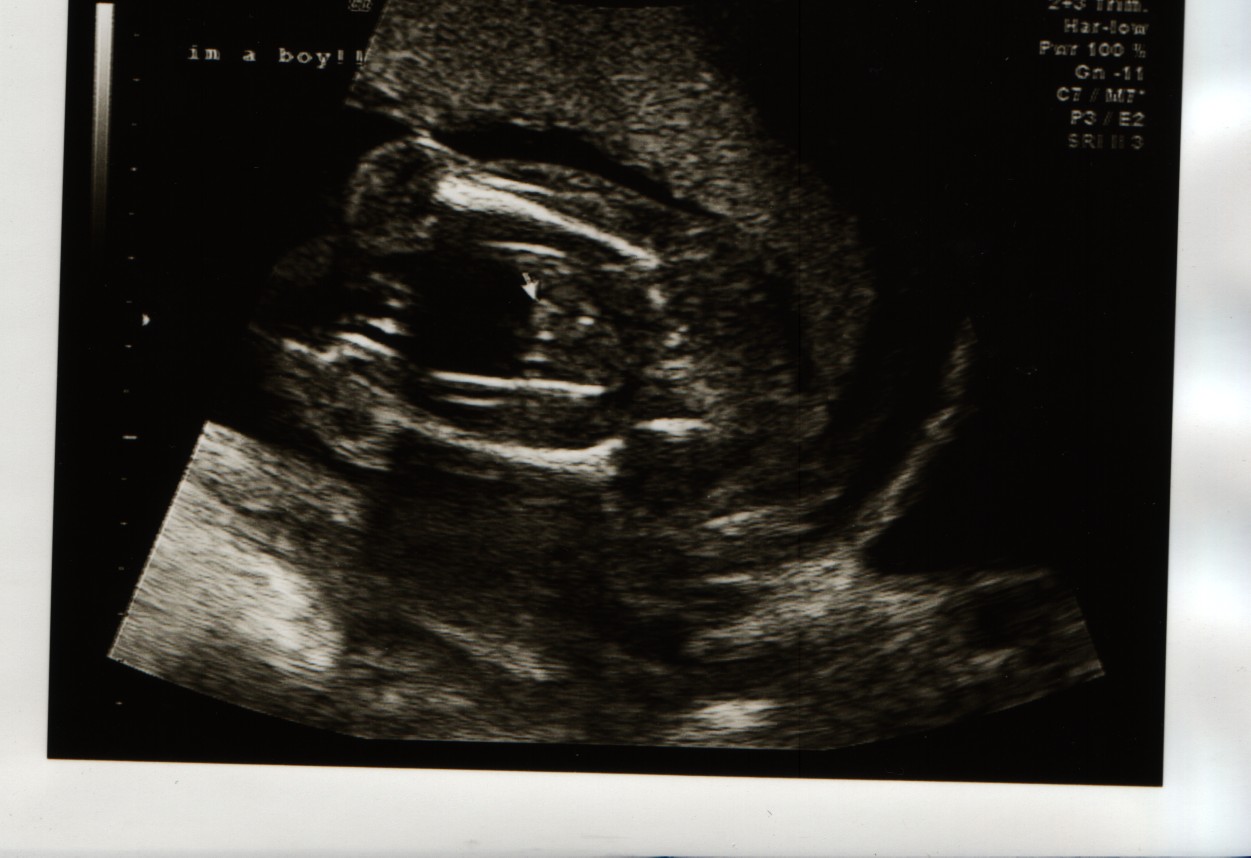 Boy Scan
