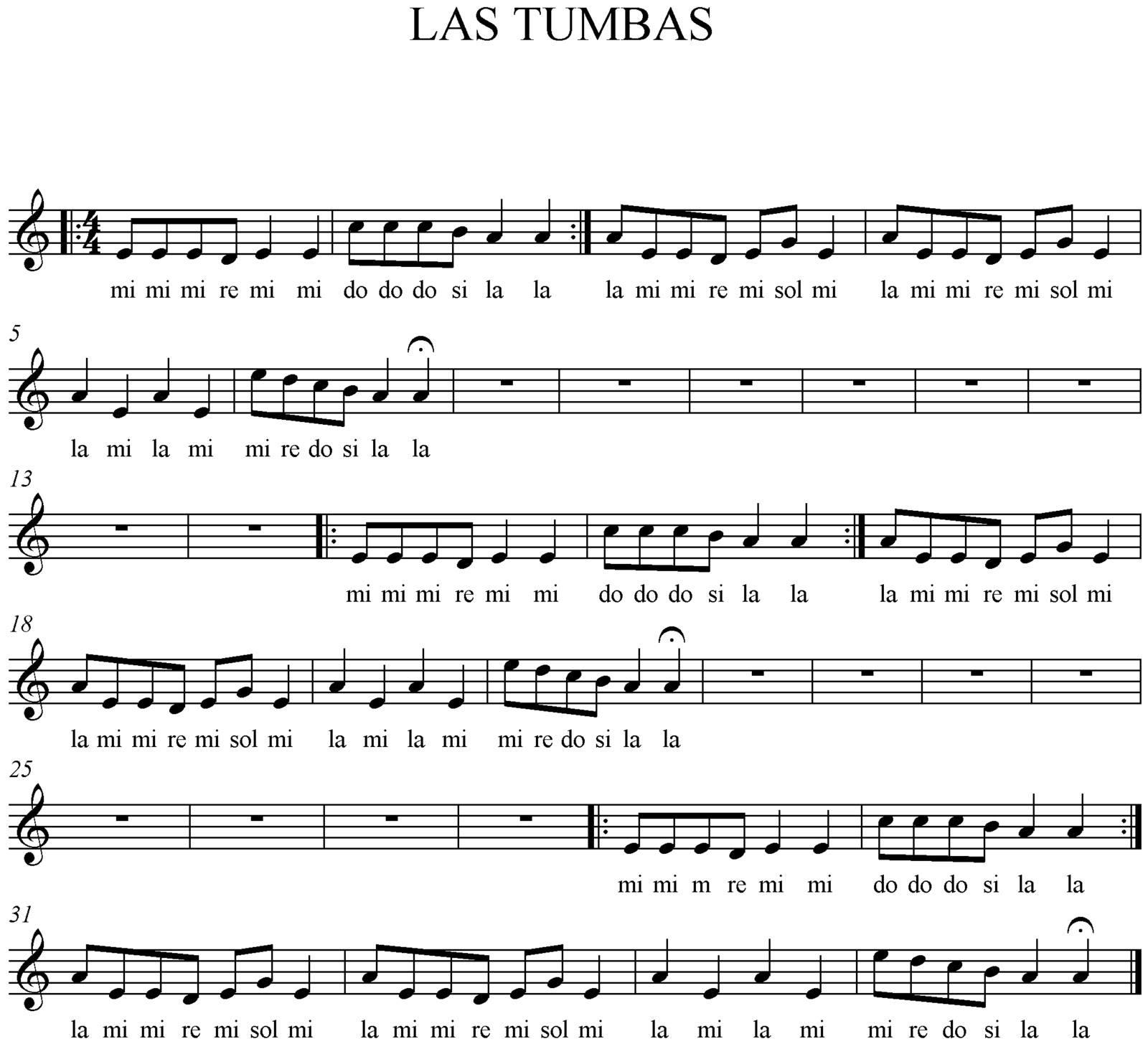 Arriba 95+ Foto Letra De La Cancion Tumbas Por Aqui Tumbas Por Alla