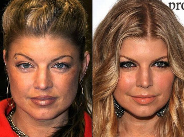 Fergie Antes y Despues Fergie Antes y Despues