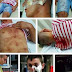 12 Albanians attacked by Macedonian Hooligans