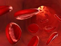 DYSLIPIDEMIA DYSLIPIDEMIA