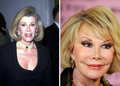 Joan Rivers Joan Rivers