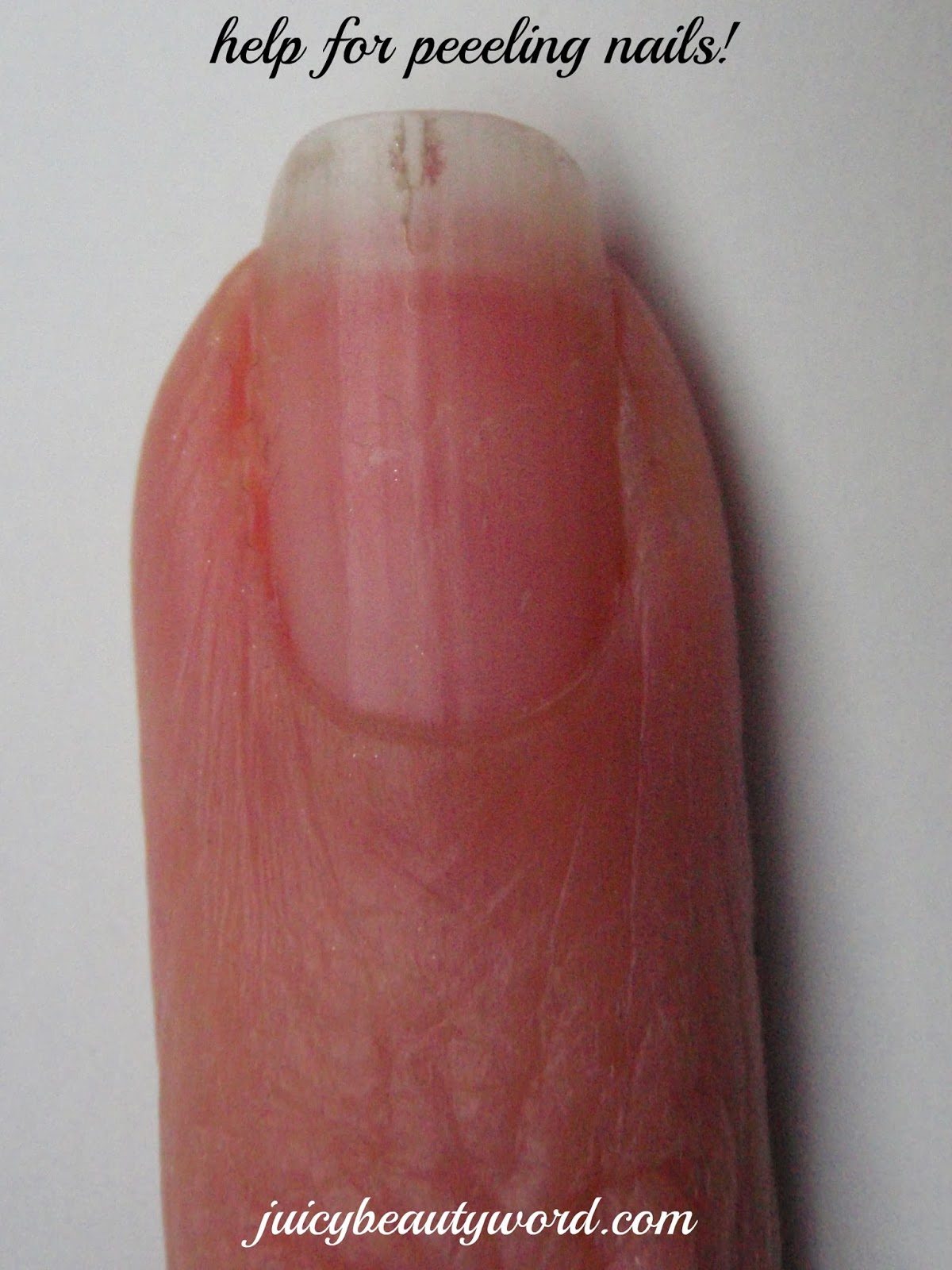 The Juicy Beauty Word Peeling Nails should you file or not to file?