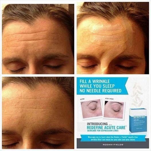 Nellie & Phoeb's: Rodan + Fields Launches Redefine Acute Care Nellie & Phoeb's: Rodan + Fields Launches Redefine Acute Care