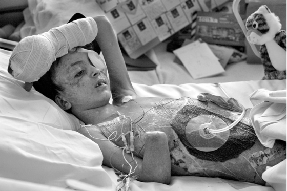 union carbide bhopal disaster case study union carbide bhopal disaster case study