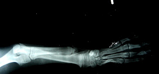 dismetria perro elongacion osea