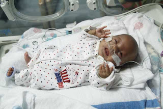 dwijayasblog.blogspot.com-bayi-seukuran-telapak-tangan dwijayasblog.blogspot.com-bayi-seukuran-telapak-tangan