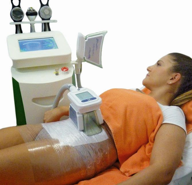 Kryolipolysevorhernachher