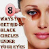 8 Ways To Get Rid of Black Circles Under Your Eyes