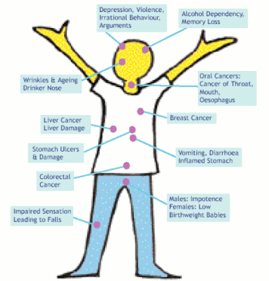 Alcohol-causes-cancer.-Unfortunately-it-