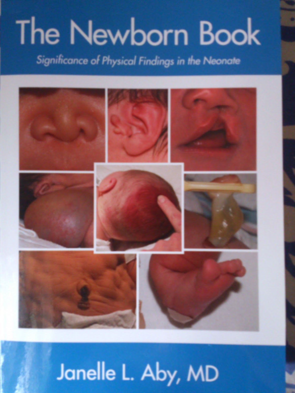 roberton's textbook of neonatology pdf free