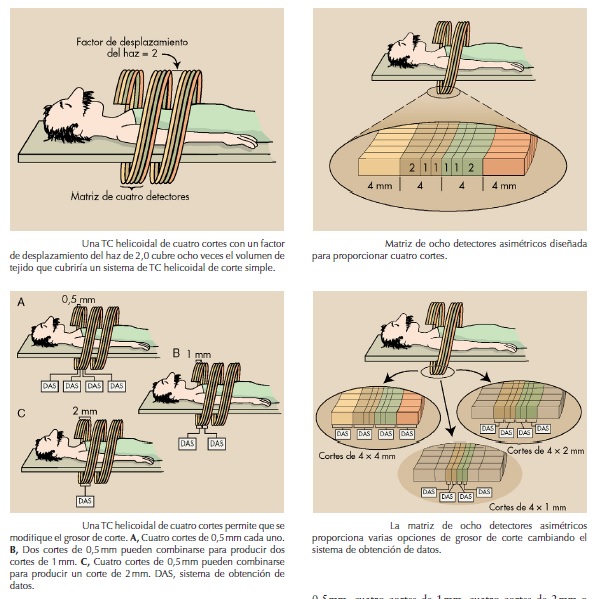 Figure 7 from Desentrañando la tecnología de la tomografía computarizada  helicoidal multicorte (TCMC)