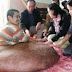 Seorang Pria Vietnam Harus Hidup Dengan Tumor 84 kg di Kakinya