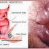Jual Salep Wasir Ardium Ampuh thumbnail