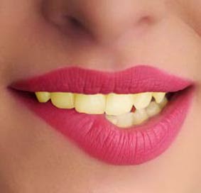 Memutihkan Gigi Kuning Dengan Photoshop Memutihkan Gigi Kuning Dengan Photoshop