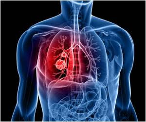 merv sheppards transplant network organ rejection risk after lung organ rejection