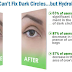 Hydrolyze – A Powerful Formula to Visibly Reduce Lines & Wrinkles