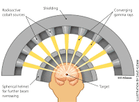 GAMMA KNIFE RADIOSURGERY GAMMA KNIFE RADIOSURGERY