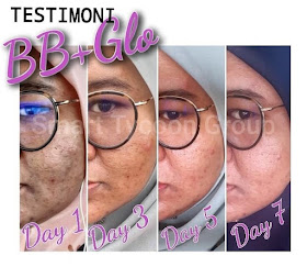 Muka teruk jerawat pulih dengan BBGlo