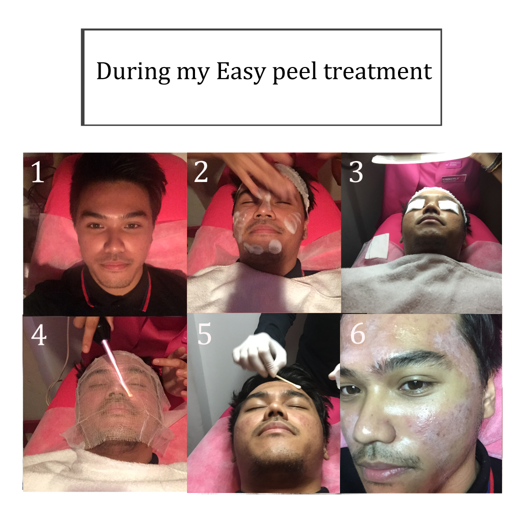 How to rejuvenate your face with peeling How to rejuvenate your face with peeling