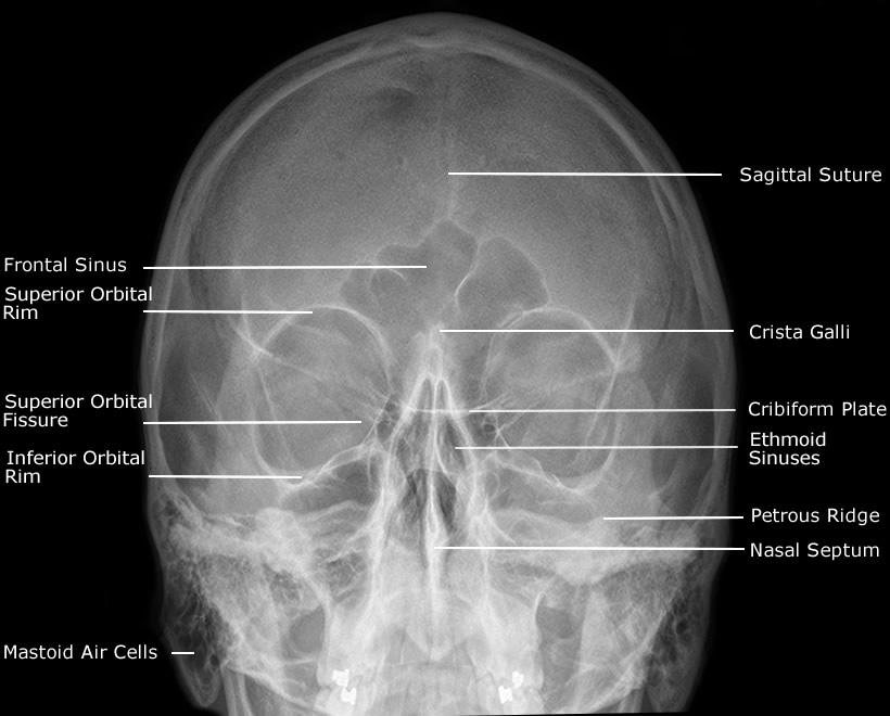 Facial Bone X Ray 63