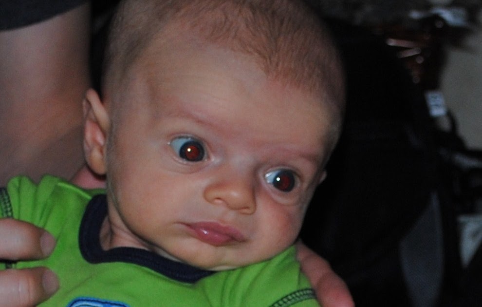 Jack's Journey The Red Eye Reflex