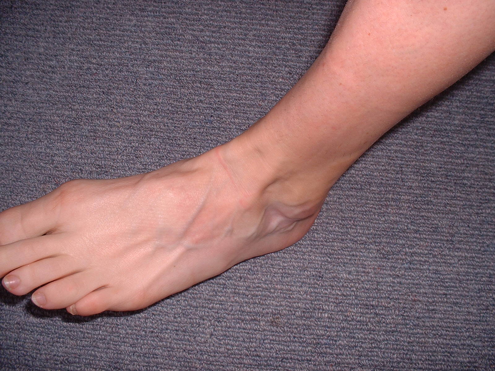 Health, Fitness Naturally! A fresh warning about