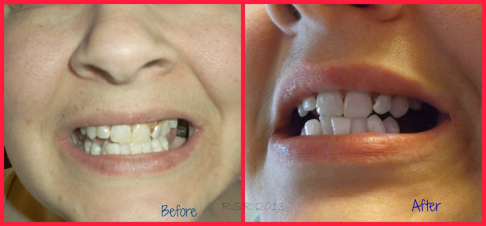 Reviews She ROTE Arm & Hammer SensitiveWhitening Toothpaste REVIEW