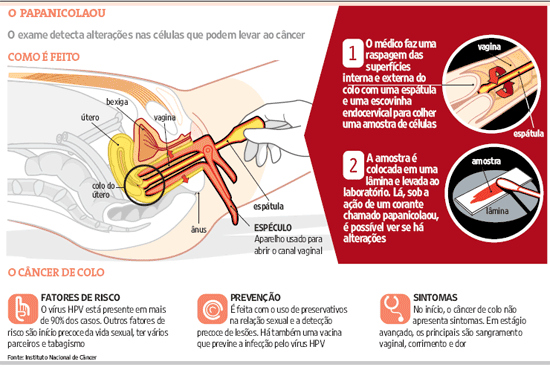 Gestante pode fazer exame preventivo