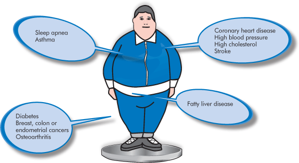 Illustration essay on obesity