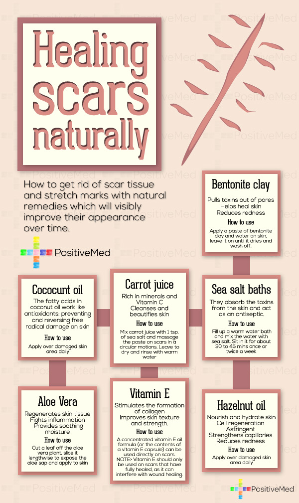 Wellness Factor Healing Scars Naturally