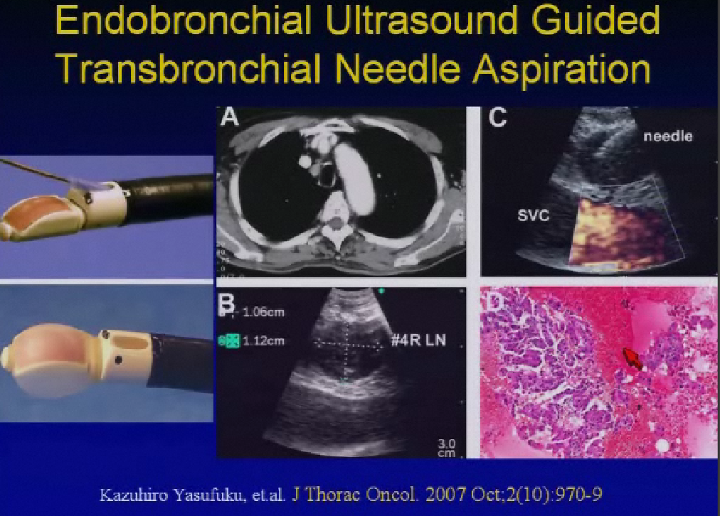 rsna RT planning and molecular imaging