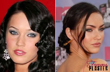 Megan Fox plastic surgery