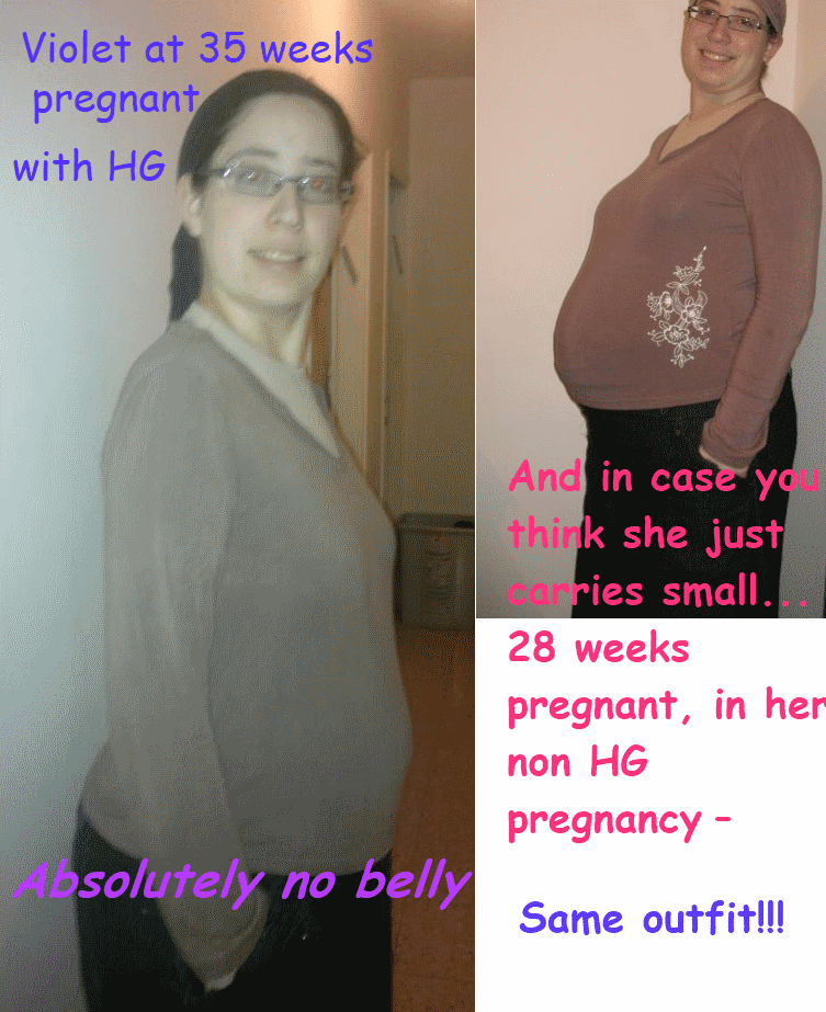 Do You Puke Your Guts Out When Pregnant? Penniless Parenting