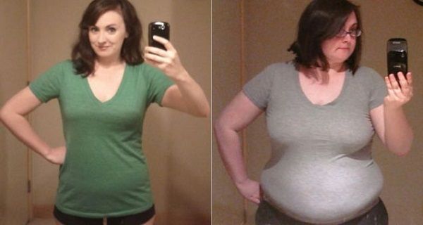 You Would Not Believe it, But a Woman was Able to Lose 40 Kilograms in a Year and This is How She Managed to Do That! weight loss