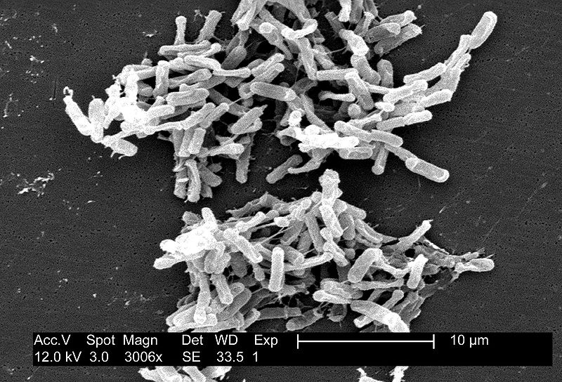 Celiac Feces