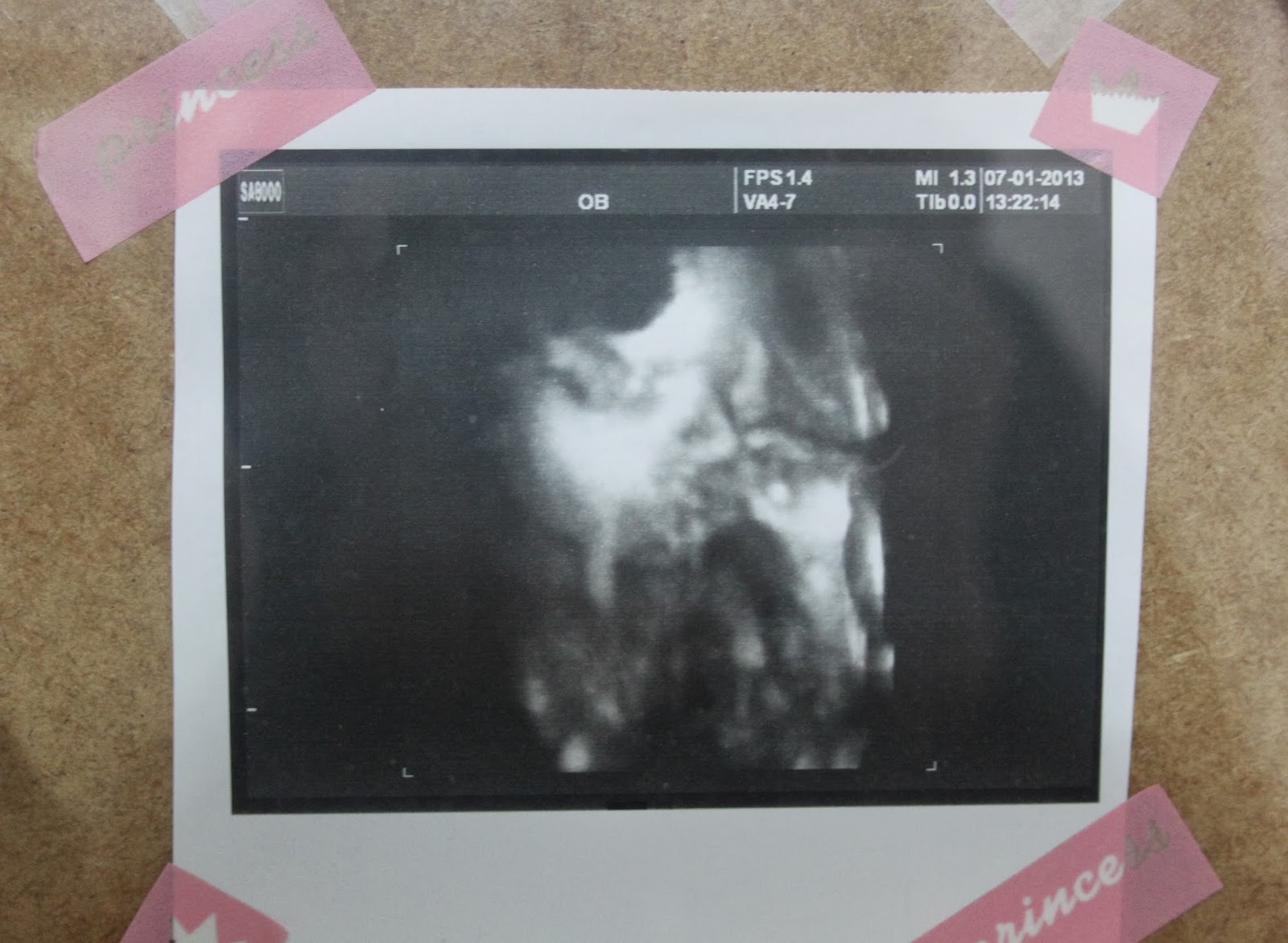 GONCA�NIN SEPETİ Diy Önerisi ; Bebeğin ilklerinden hatıra çerçeve yapmaca