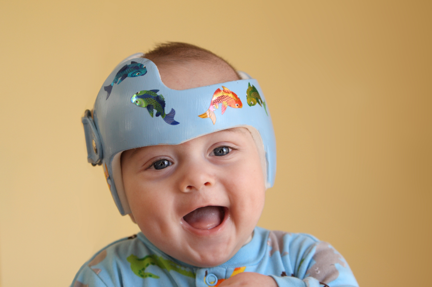 Pediatric Occupational Therapy Tips Plagiocephaly & Torticollis