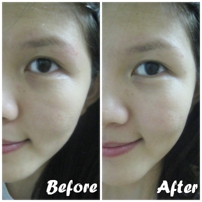 masker nuface