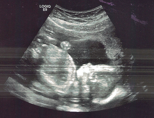 sagebrush coast halfway baby 20 weeks my pregnancy halfway point 500x382 sagebrush coast halfway baby 20 weeks my pregnancy halfway point 500x382