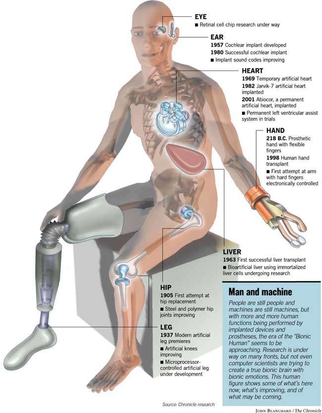 synthetic limbs