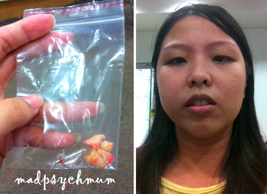 Para que sirve el mango africano y garcinia cambogia photo 2