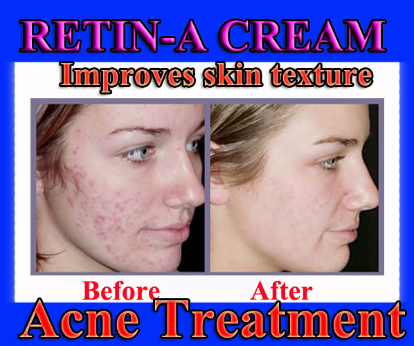 Retin A Scar Cream