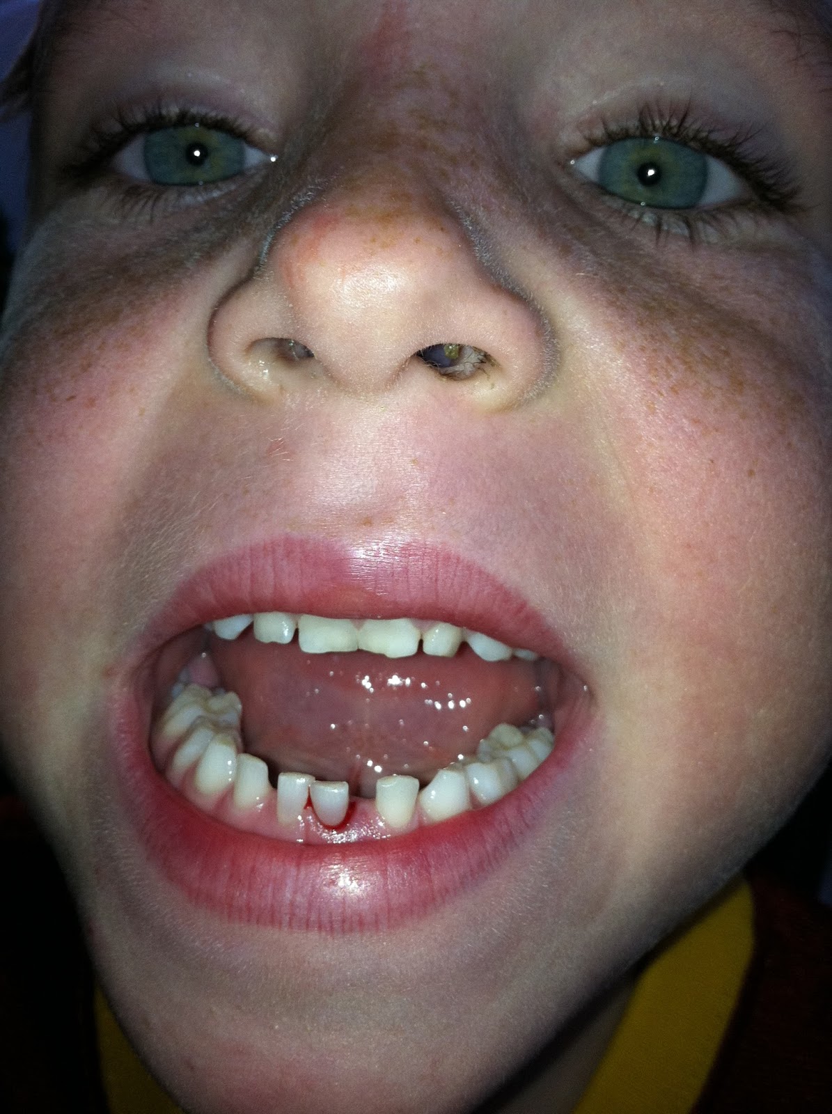 Adventures with Aidan I Pledge Allegiance to the Tooth. . .Nothin' But