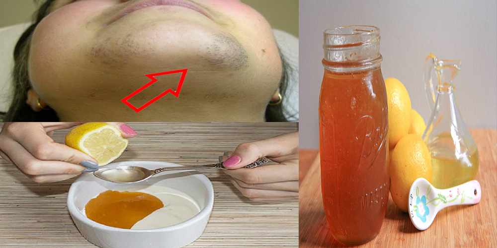 Natural Remedies to Get Rid of Unwanted Chin Hair Life With Styles