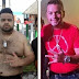 FELIPE LEMOS COMPLETAMENTE DIFERENTE DEPOIS DE CIRUGIA