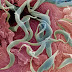 Filum Nemathelmintes thumbnail
